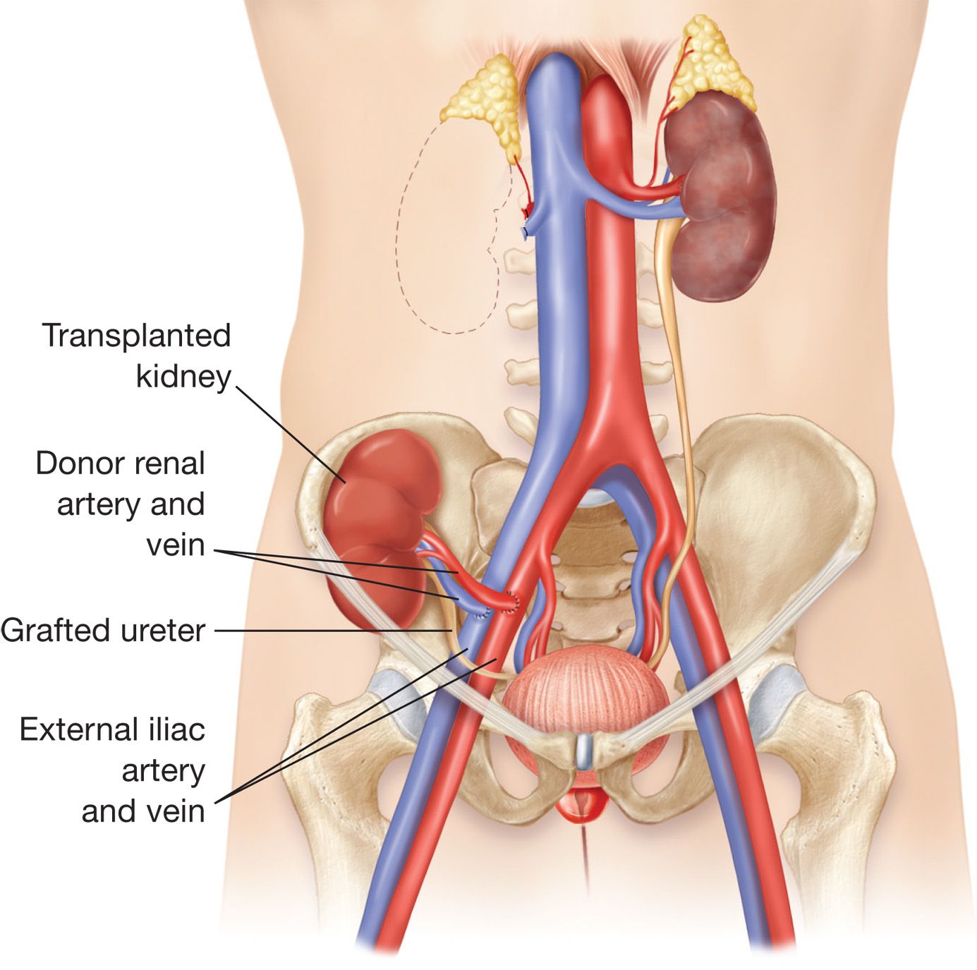 Things You Need to Know Before & After Undergoing a Kidney ...