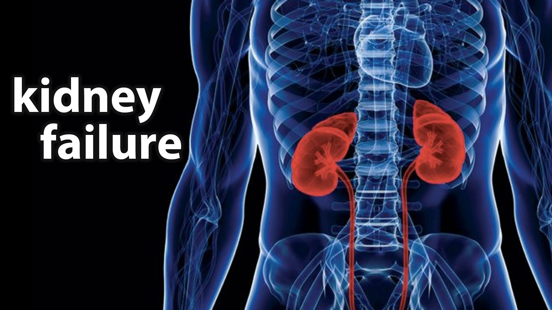 Types of Kidney Failure