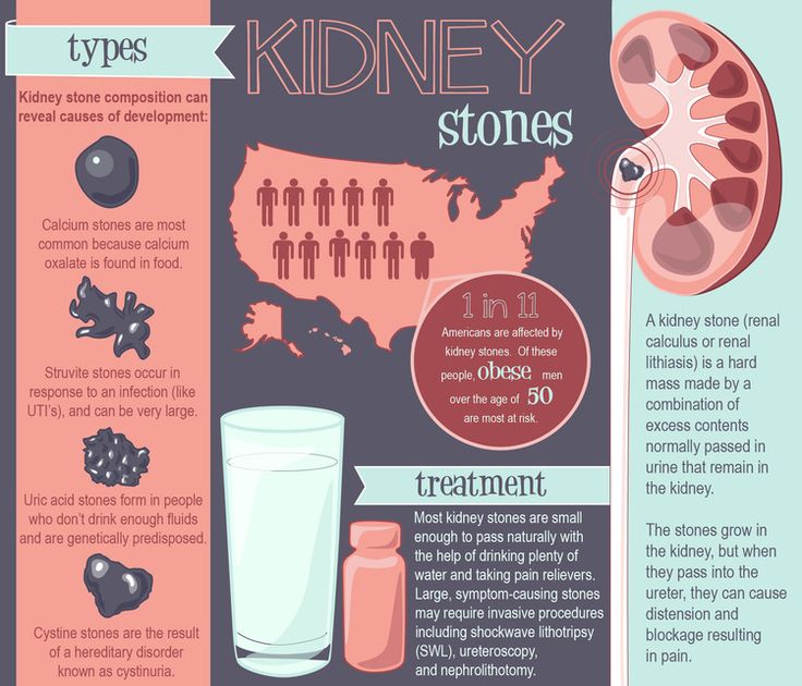Types of Kidney Stones