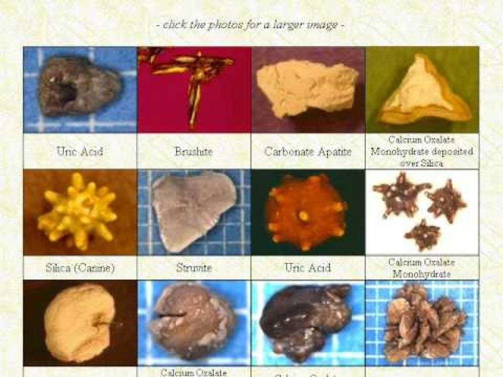 types of stones