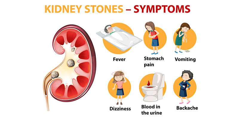 What are early signs of kidney stones?  Chennai