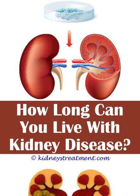 What Are Stages Of Kidney Cancer