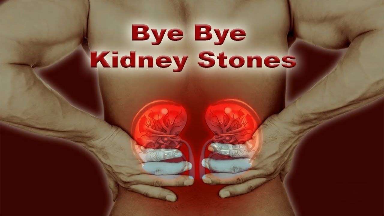 What Doctor Do I See For Kidney Stones