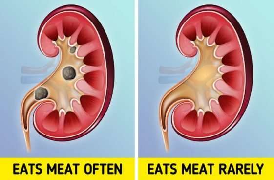 What Happens in Your Body If You Eat Too Much Meat ...