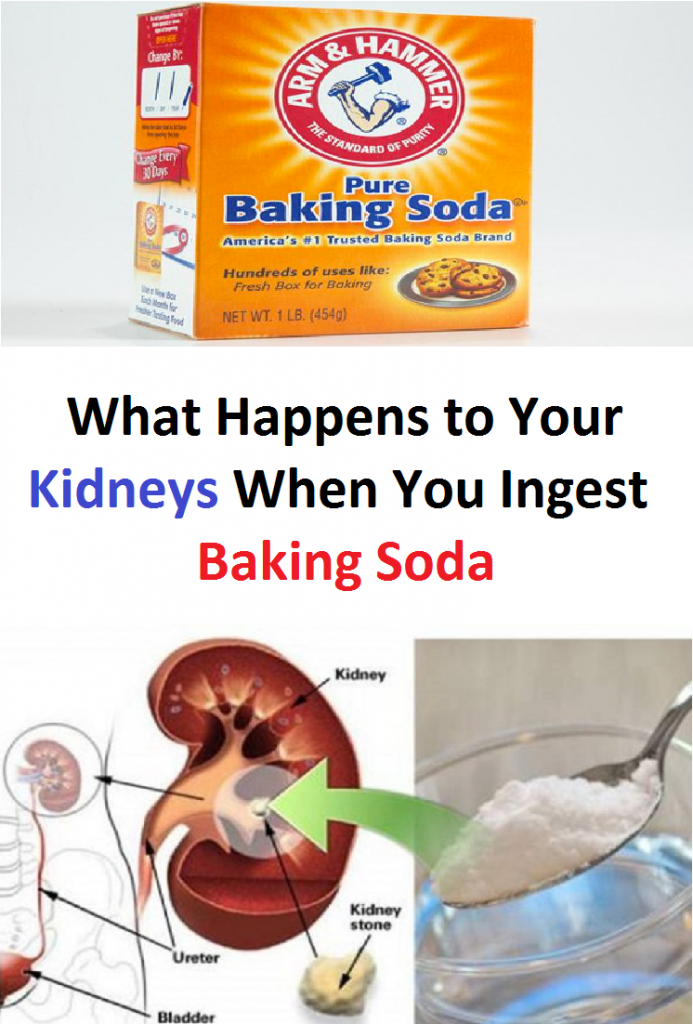 What happens to your kidneys when you ingest baking soda ...