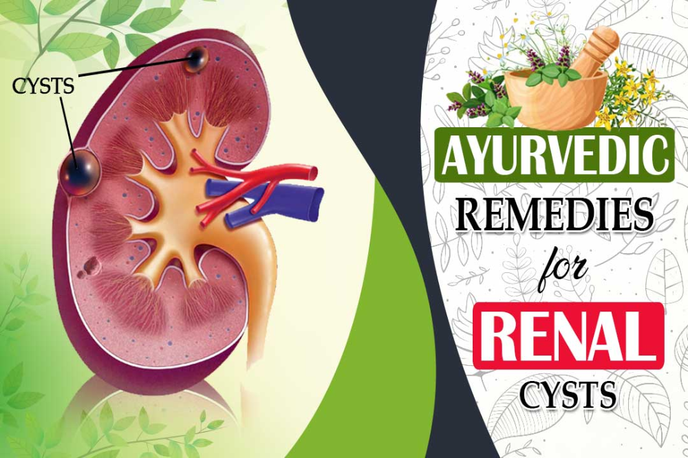 What Helps With Kidney Cysts
