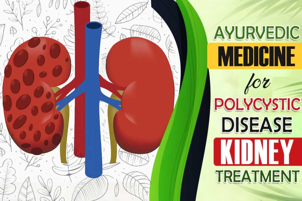 What is Polycystic kidney disease, symptoms, causes &  treatment?