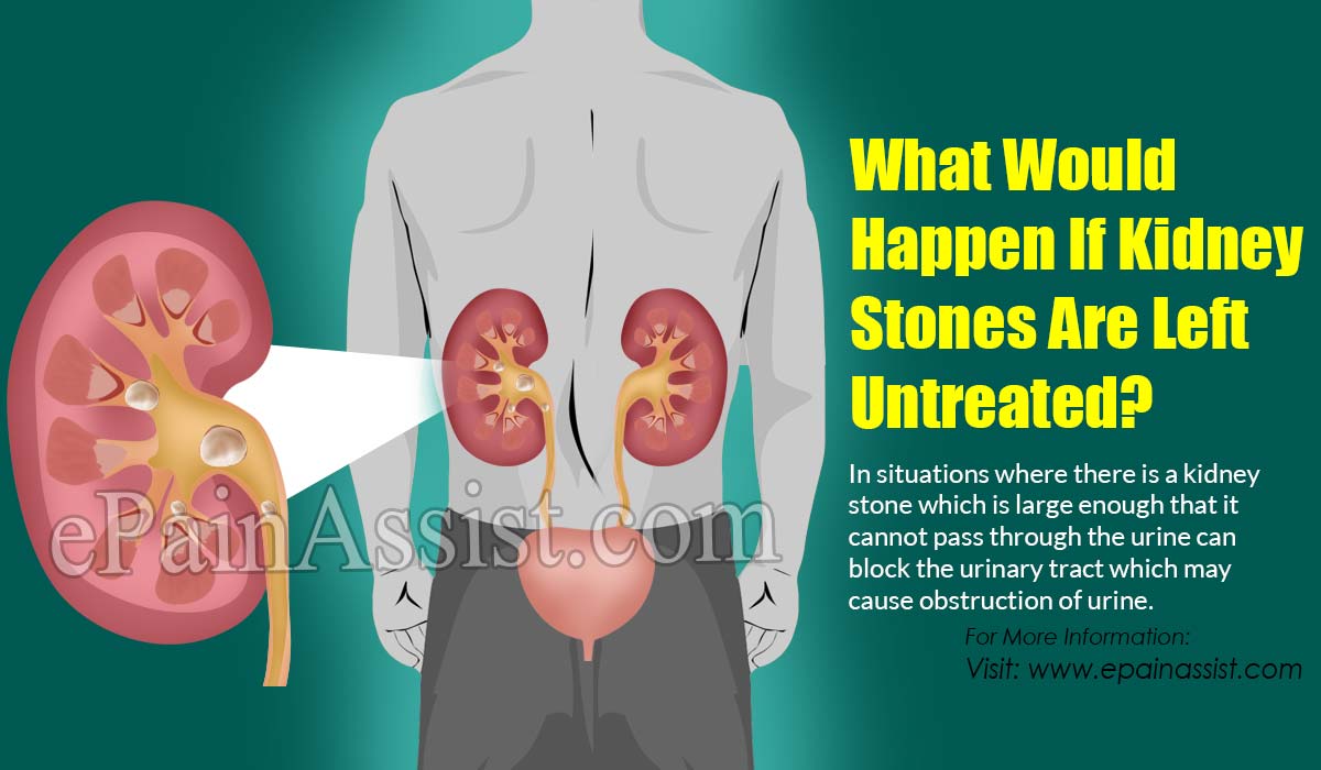 What Would Happen If Kidney Stones Are Left Untreated